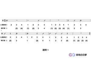 休止符